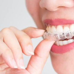 Clínica Dental Sm - Invisalign Provider (ortodoncia Invisible) Brackets / Blanqueamiento Dental / Dentista