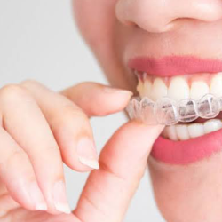 Clínica Dental Sm - Invisalign Provider (ortodoncia Invisible)
