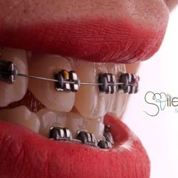 Clinica Dental Smile Center Gdl