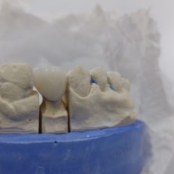 Clinica Dental Tolcayuca