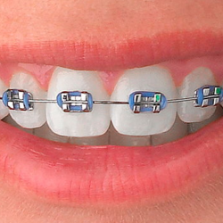 Clínica Dental Vivesonrisa