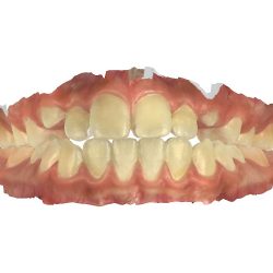 Clínica Dental Y Ortodoncia En Satelite Dra Claudia Cárdenas