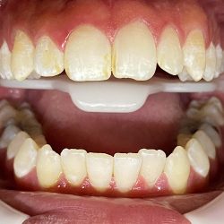 Clínica Especializada En Ortodoncia - Dr. Alan Arce