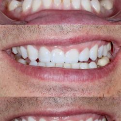 Clinica Luna Dental
