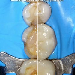 Clínica Odontológica De Xalapa