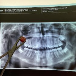 Clínica Willy - Dent