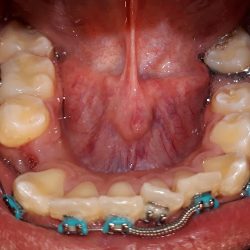 Coes-dental