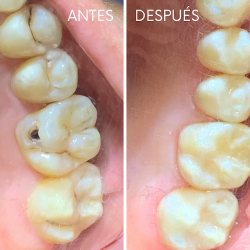 Consultorio Dental Acosta