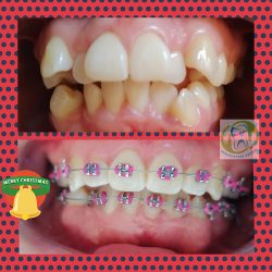 Consultorio Dental Agencia Vicente Guerrero