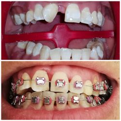 Consultorio Dental Bio Dent (dra. Mancilla)