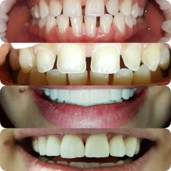 Consultorio Dental Co - Dent
