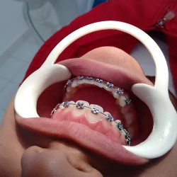 Consultorio Dental Continentes