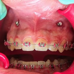 Consultorio Dental :dentaclean V&r