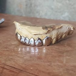 Consultorio Dental Dentista Maicol Navarro Luna