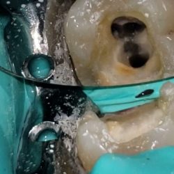 Consultorio Dental Diente Sano
