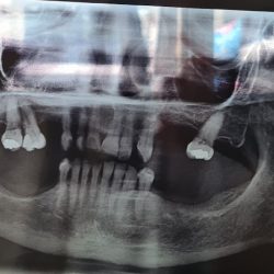 Consultorio Dental Dr.ignacio Valenzuela