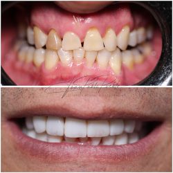 Consultorio Dental Dr. Puebla
