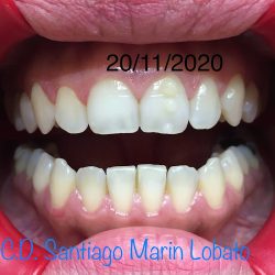 Consultorio Dental Dr. Santiago Marin Lobato