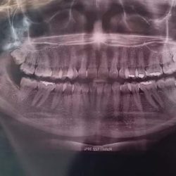 Consultorio Dental Dra. Dinah Verdugo Llanas