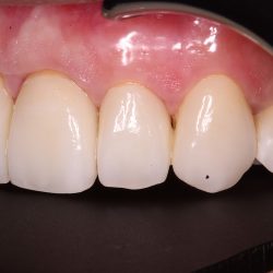 Consultorio Dental Dra. Gabriela Maza