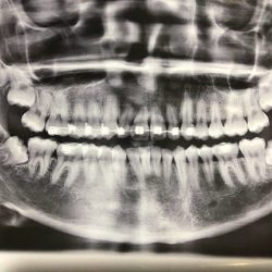 Consultorio Dental Dra.-lucero Rayón C