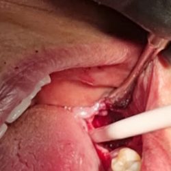 Consultorio Dental Dra. María Trinidad Félix López Cirujano Dentista