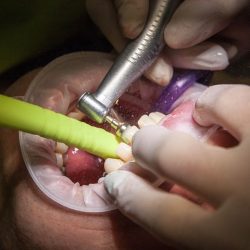 Consultorio Dental Dra. Norma A.bobadilla Z.