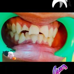 Consultorio Dental Dra Xitlalli Velueta