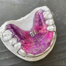Consultorio Dental Dra. Yulli Garcia Atención Dental Para Niños Y Adultos.