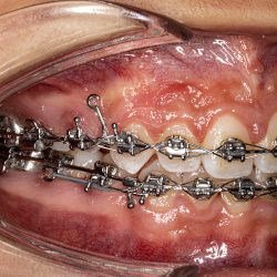 Consultorio Dental D'smile