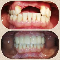 Consultorio Dental Familiar
