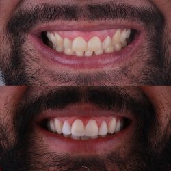 Consultorio Dental | G&g Arte Dental Ixtapaluca