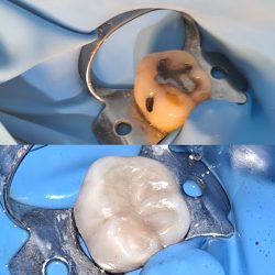 Cónsultorio Dental Health Acosta