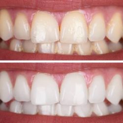 Consultorio Dental Integral