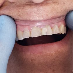 Consultorio Dental, José Guadalupe Moreno Ibarra