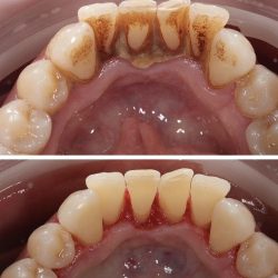 Consultorio Dental Karina Cerpa Rosas