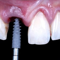 Consultorio Dental López & Mejorada