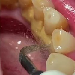 Consultorio Dental Muelitas