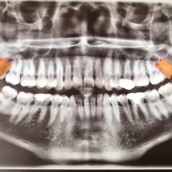 Consultorio Dental Mundo Diente