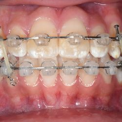 Consultorio Dental Odontología Integral C.d. Mireya Olvera Uaeh