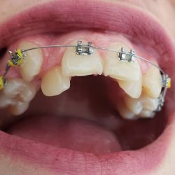 Consultorio Dental Odontología Integral