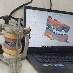 Consultorio Dental - Odontología Reconstructiva, Prótesis & Implantes
