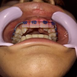 Consultorio Dental Regina