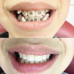 Consultorio Dental Ruvalcaba