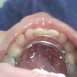 Consultorio Dental San Juan