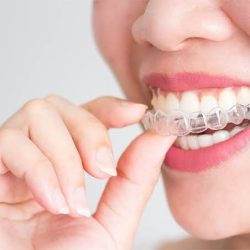 Consultorio Dental Santa Rita