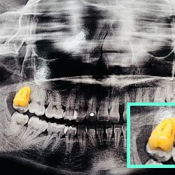 Consultorio Dental: Vzq Odontologia Familiar