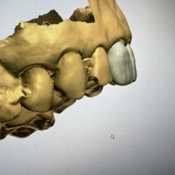 Consultorios Dentales Xi Huetzca