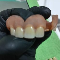 Cosmética Dental