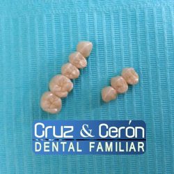 Cruz & Cerón Dental Familiar